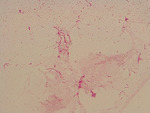 MISSING THUMBNAIL